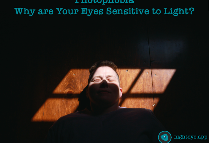 Photophobia why your eyes are sensitive t light | Night Eye